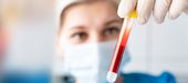Was ist eine Eigenblut-Therapie in der Zahnmedizin?